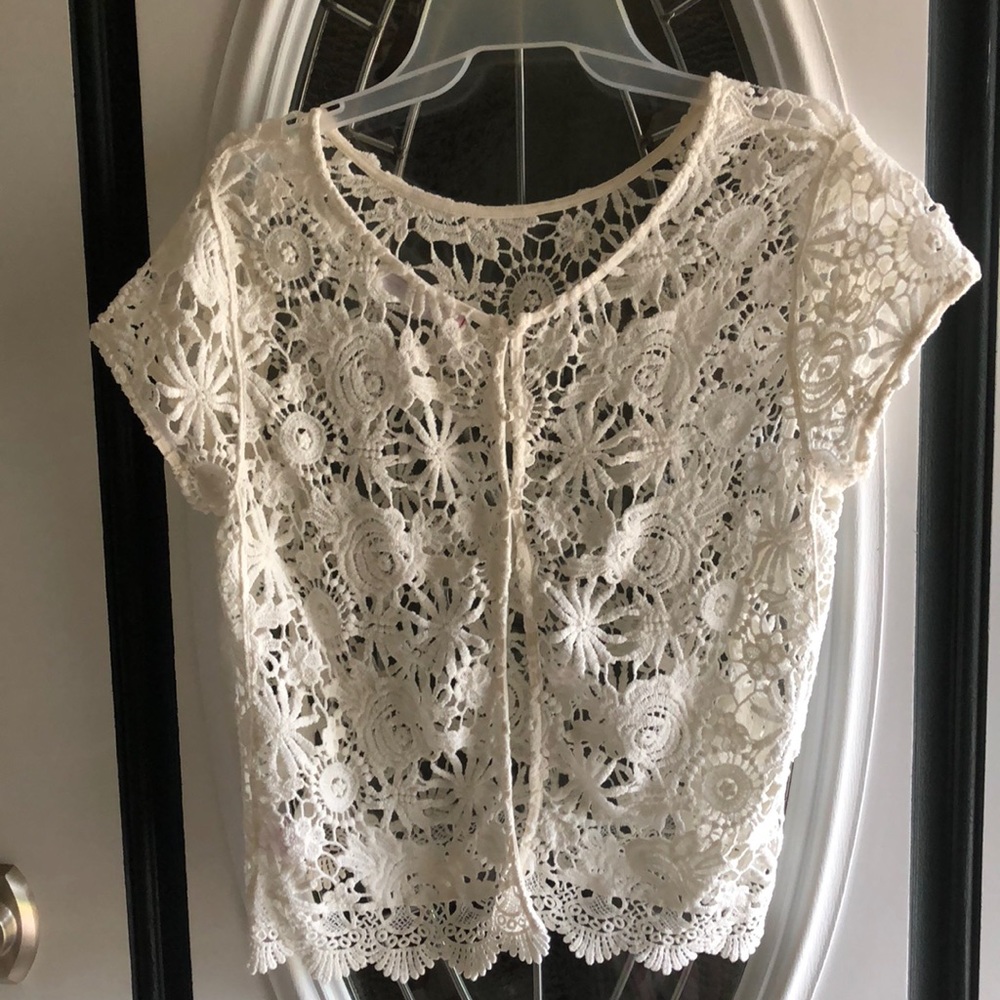 Lace short sleeve button cover